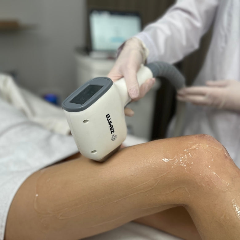 Zemits Quidion Laser a Diodo per la Rimozione dei Peli