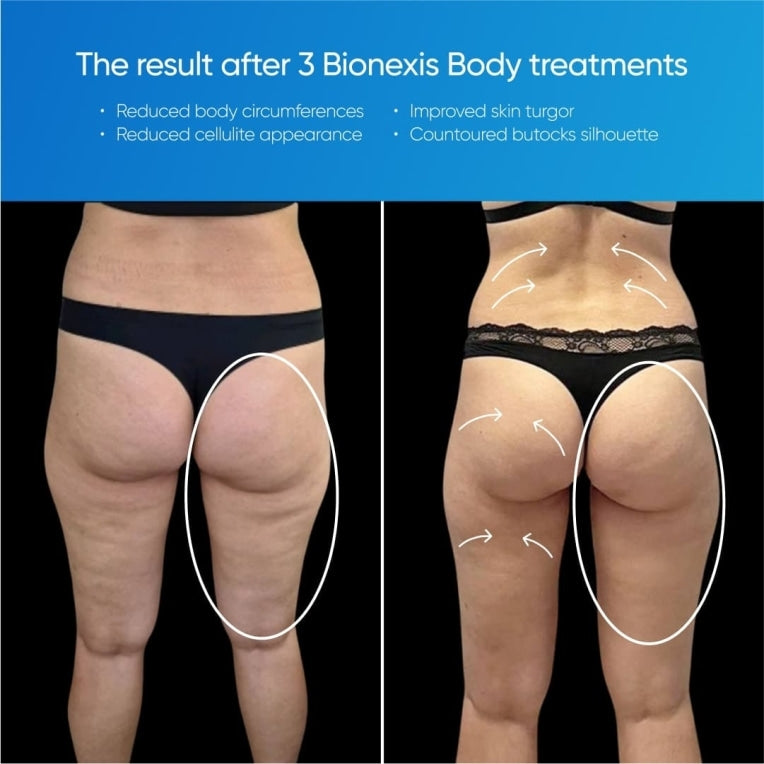 Zemits Bionexis Lite Pro Sistema di Contouring