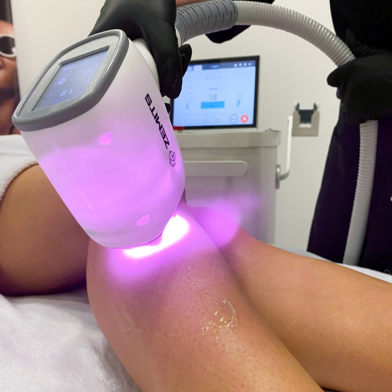 Zemits Quidion Laser a Diodo per la Rimozione dei Peli
