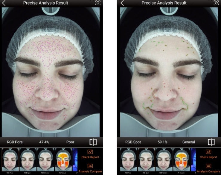 Zemits VeraFace Sistema di Analisi della Pelle