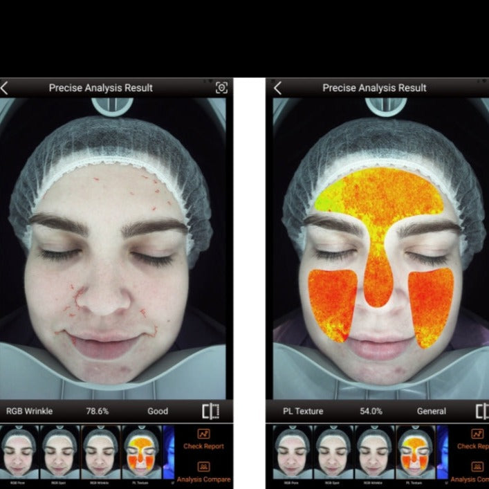 Zemits VeraFace Sistema di Analisi della Pelle