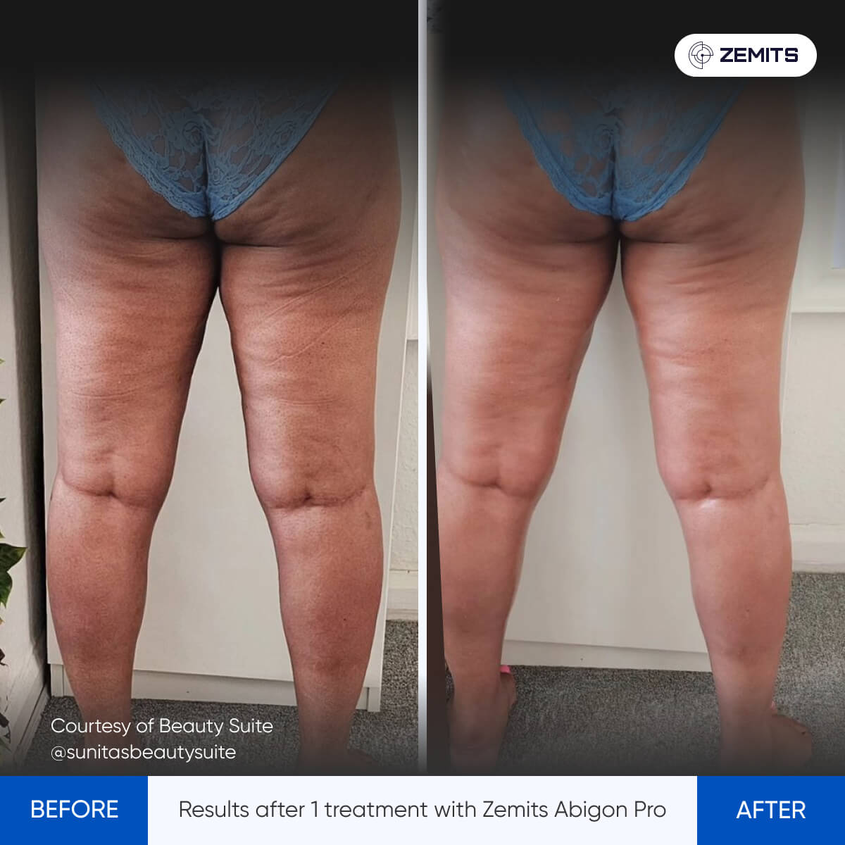 Before After Slide 3