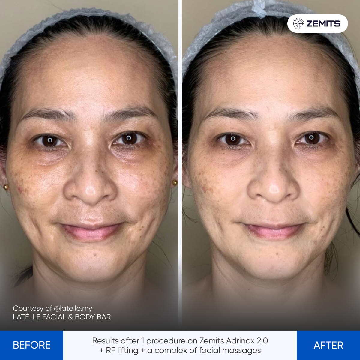 Before After Slide 2