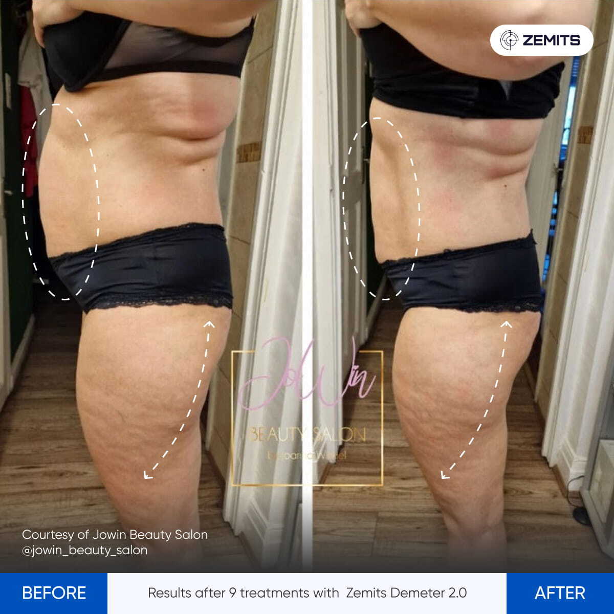 Before After Slide 2