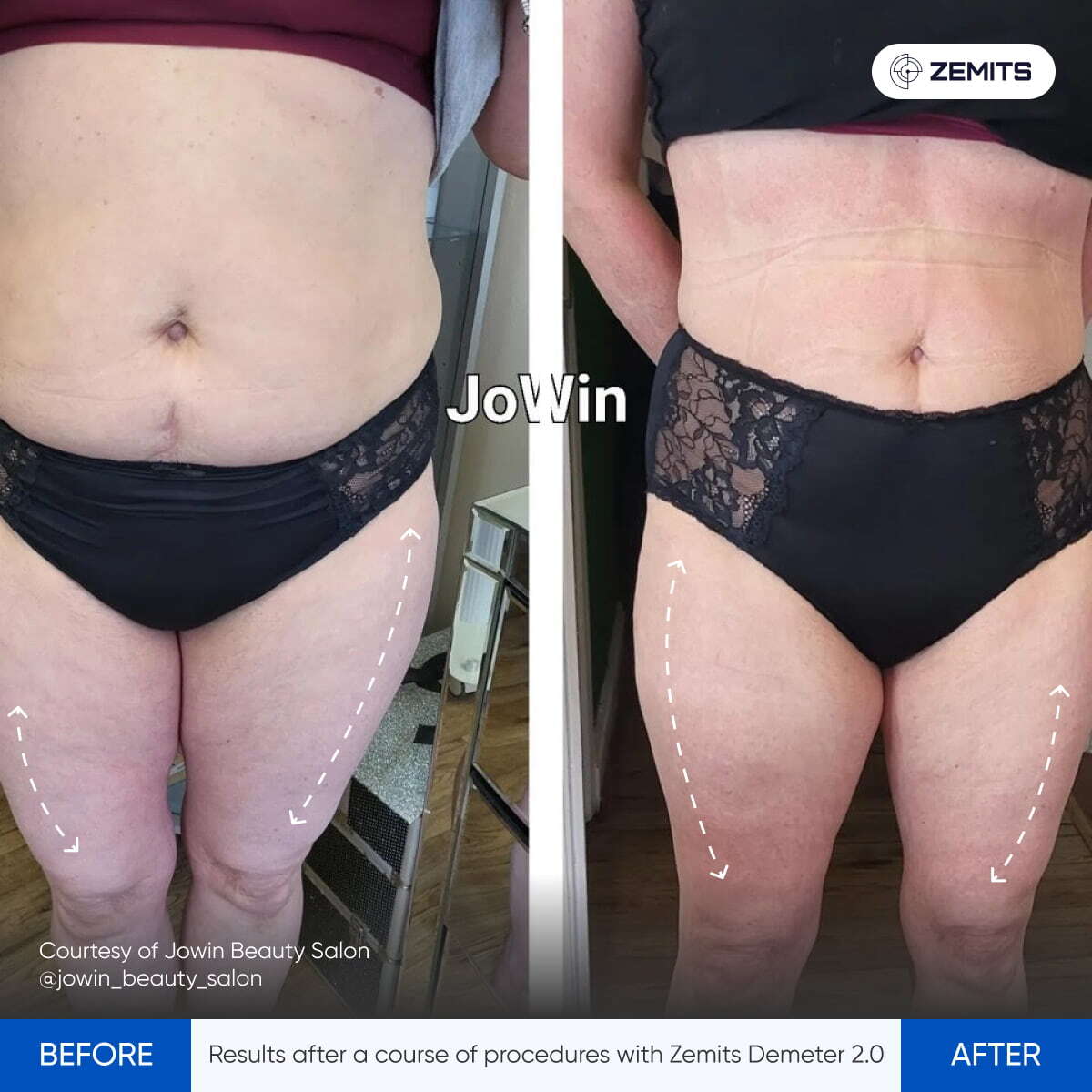 Before After Slide 5