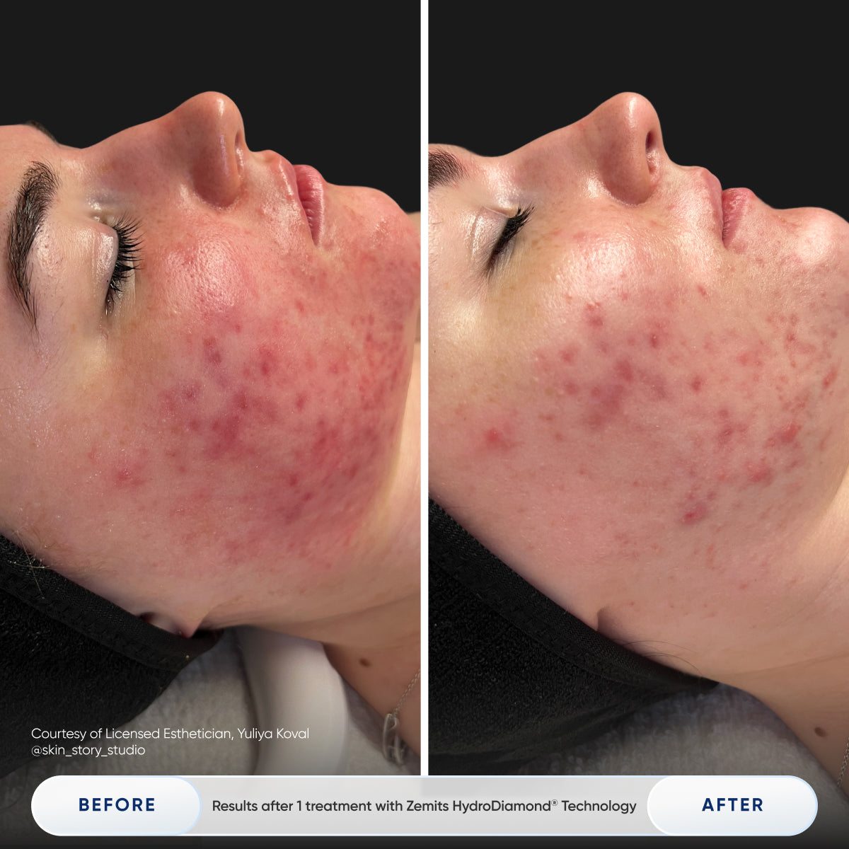 Before After Slide 3