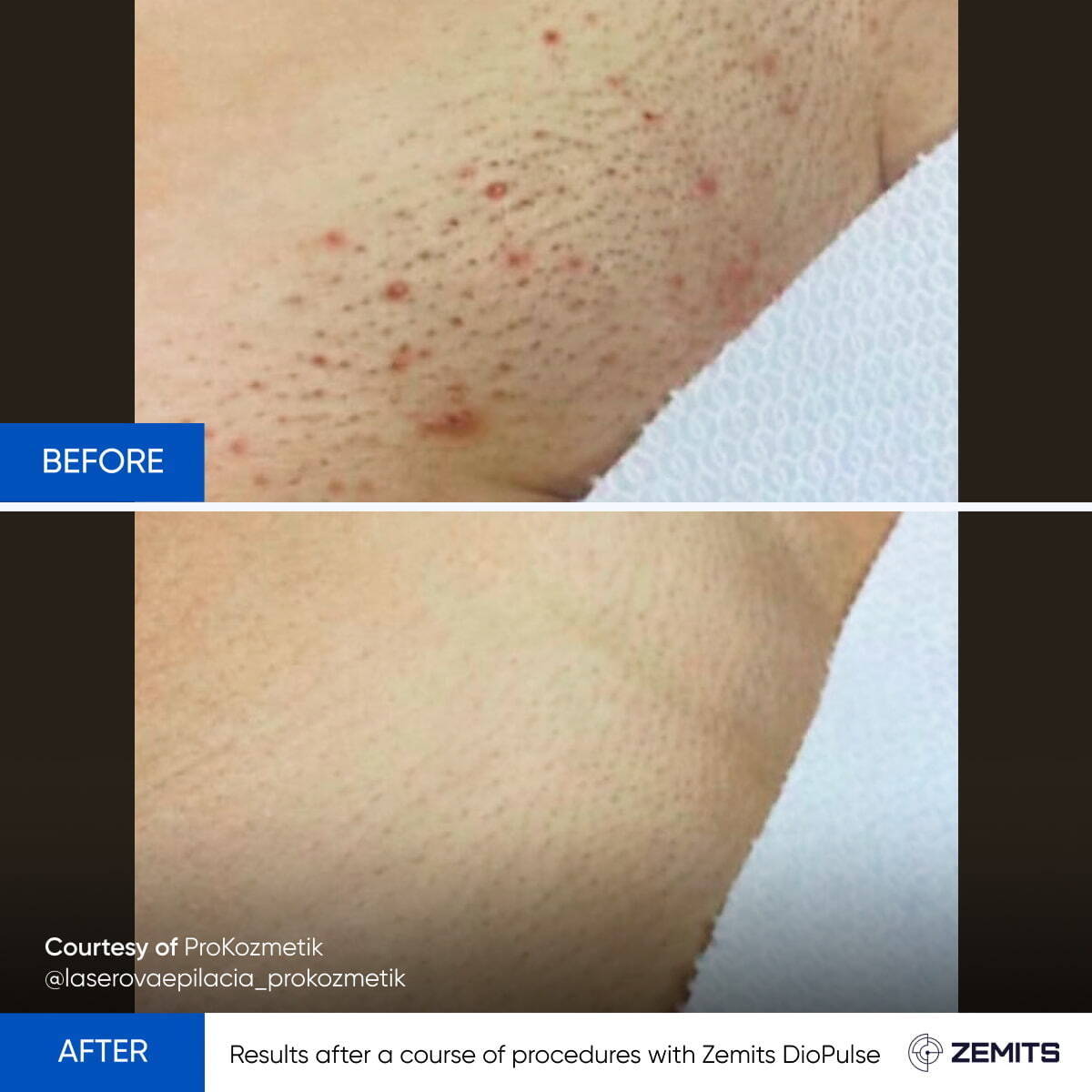 Before After Slide 2