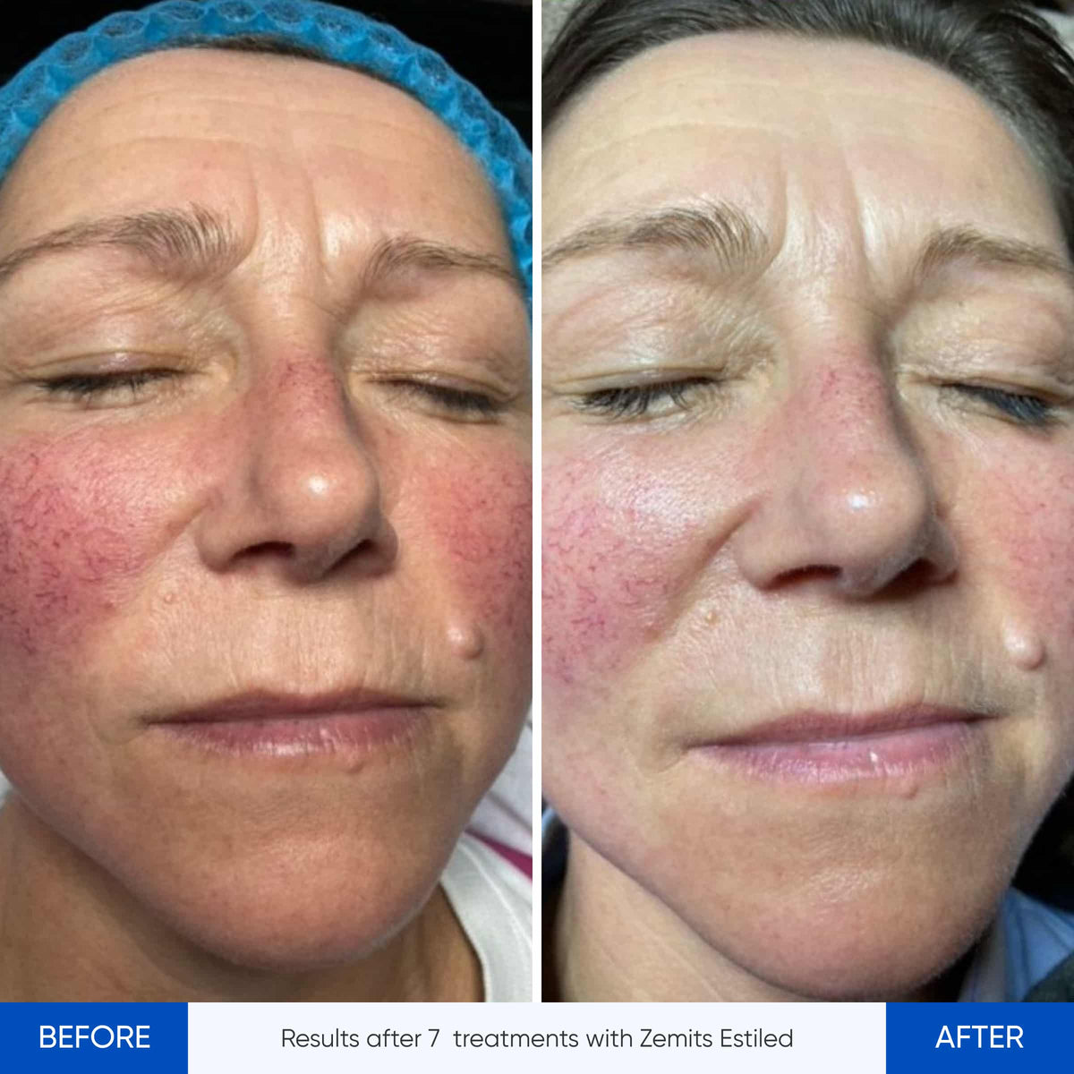Before After Slide 2