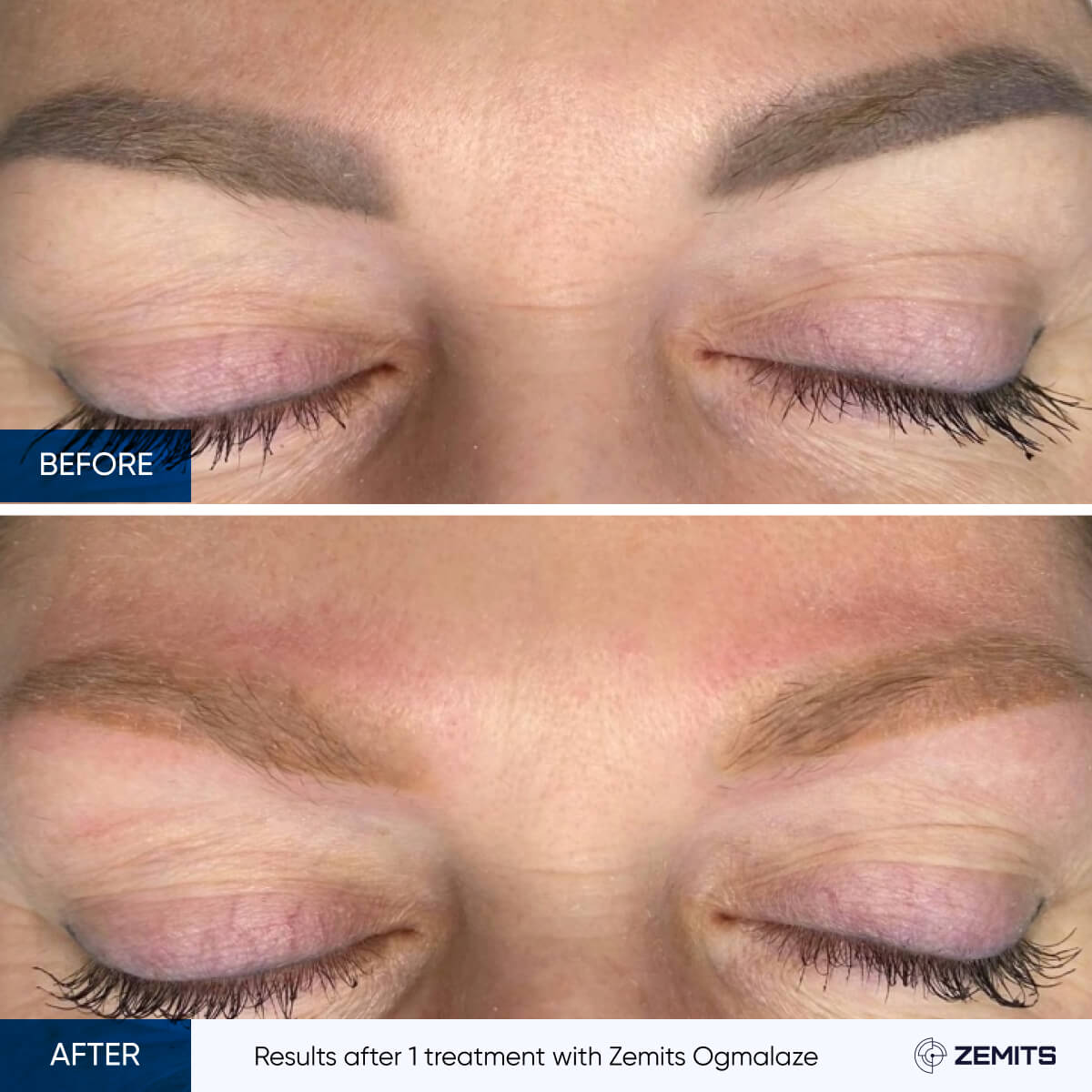 Before After Slide 5