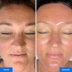 Zemits OxiVelour Pro