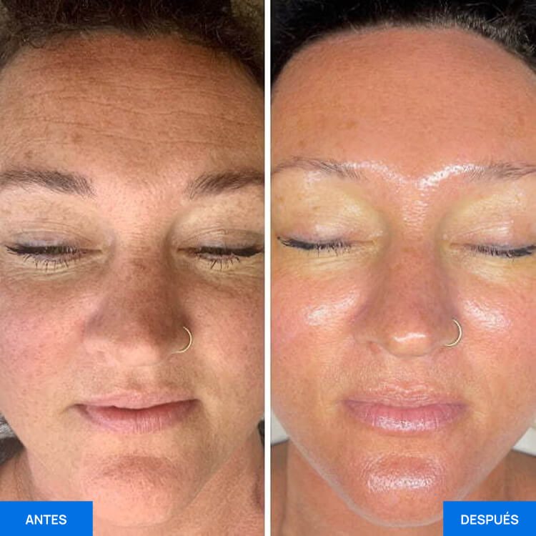 Zemits OxiVelour Pro
