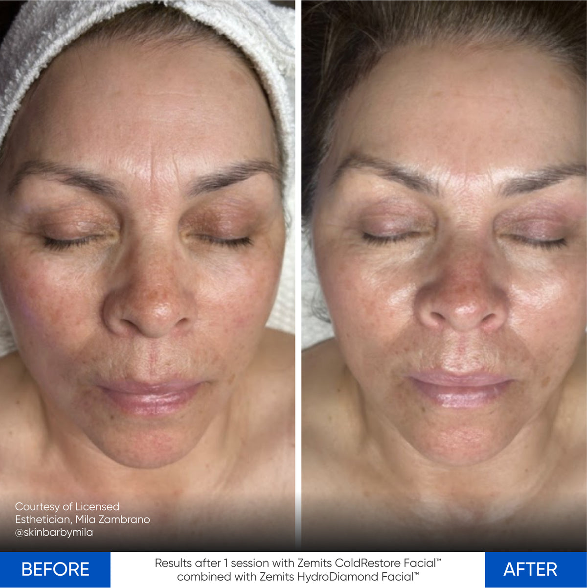 Before After Slide 15