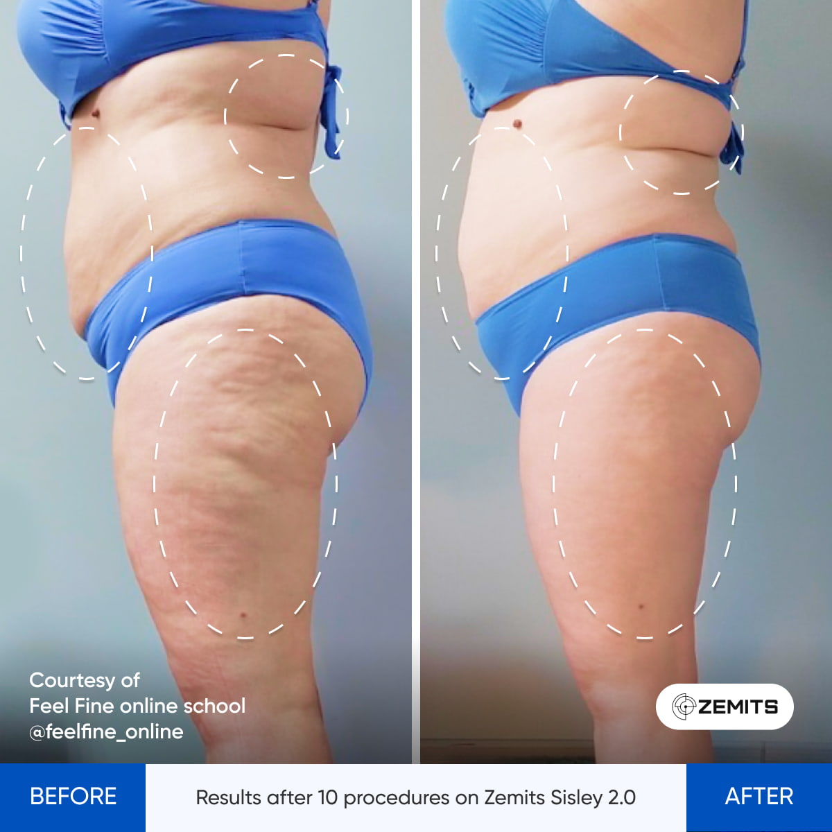 Before After Slide 5
