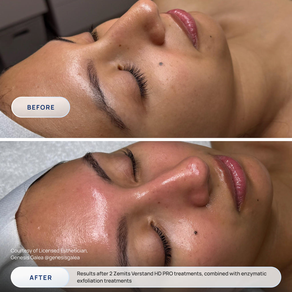 Before After Slide 1