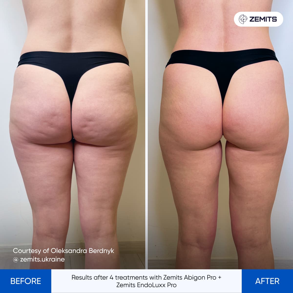 Before After Slide 1