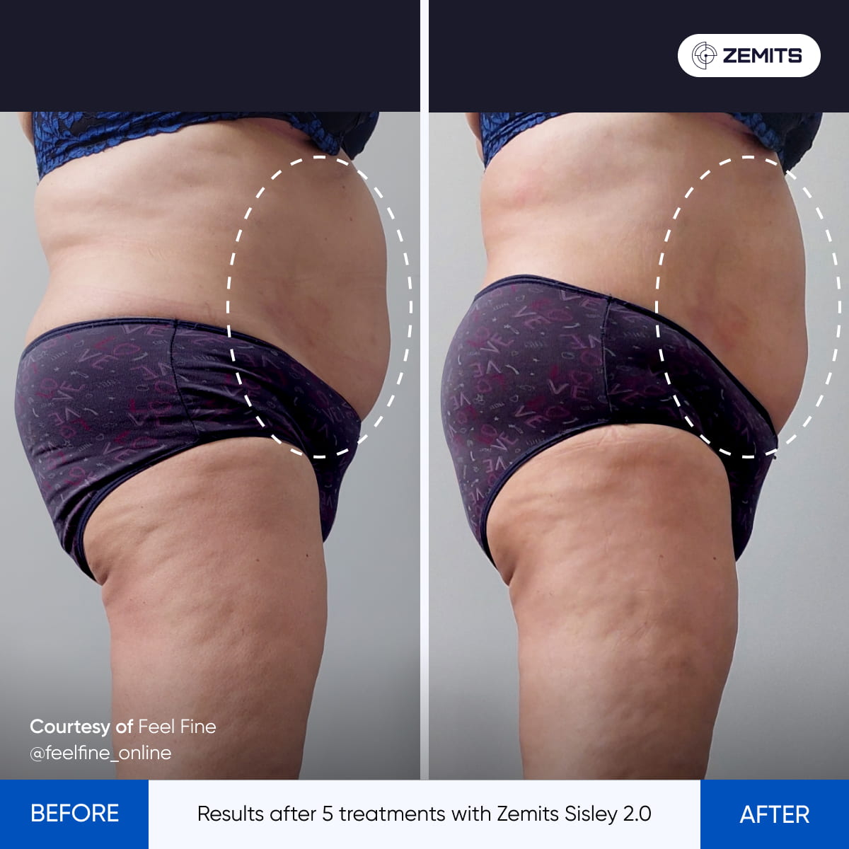 Before After Slide 4