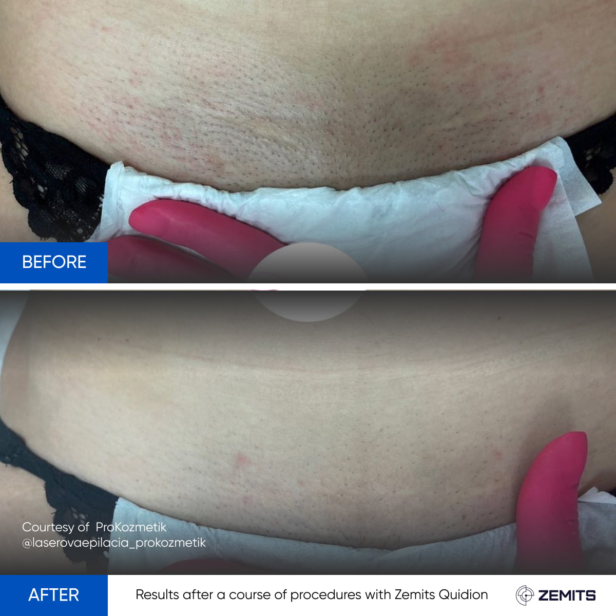 Before After Slide 7