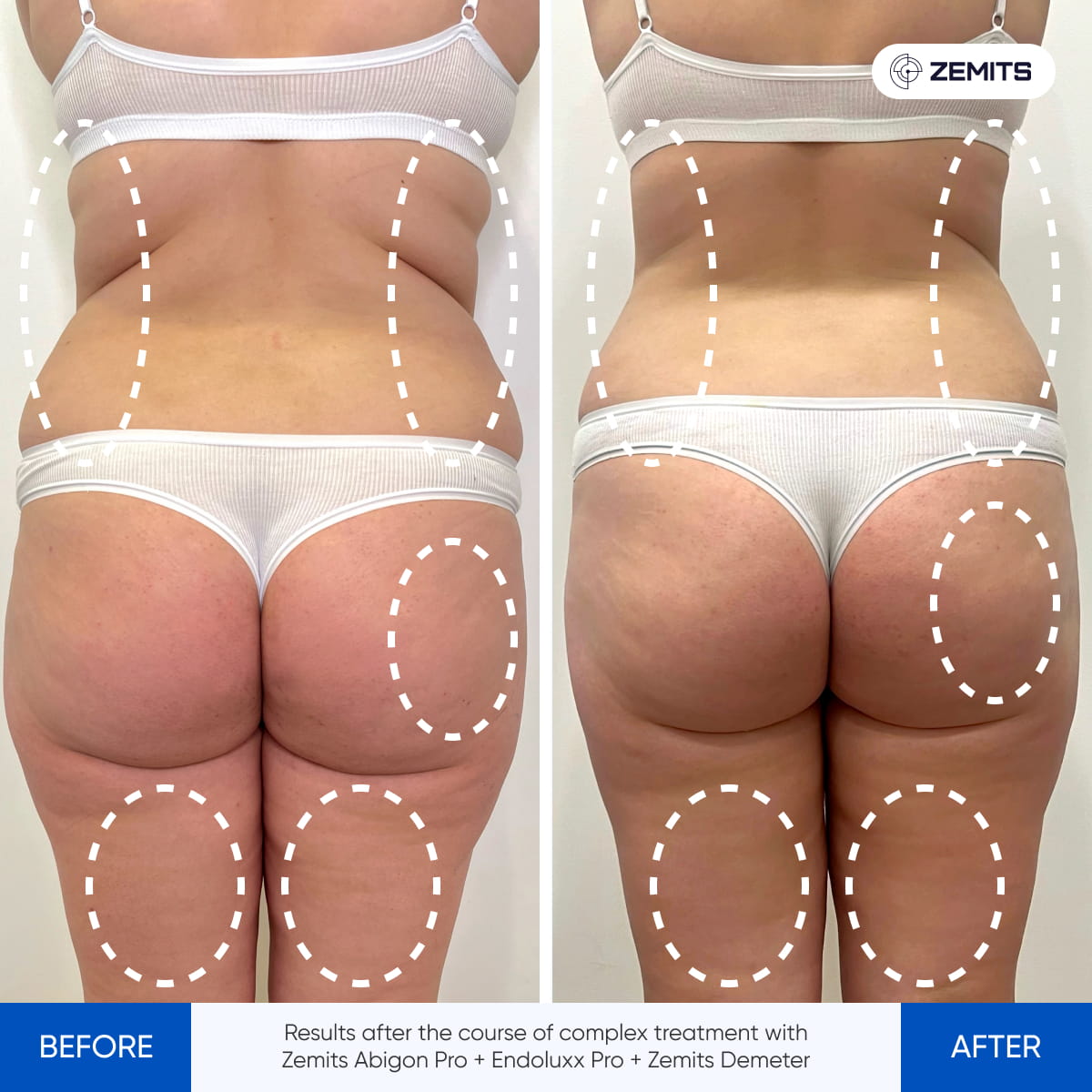 Before After Slide 7