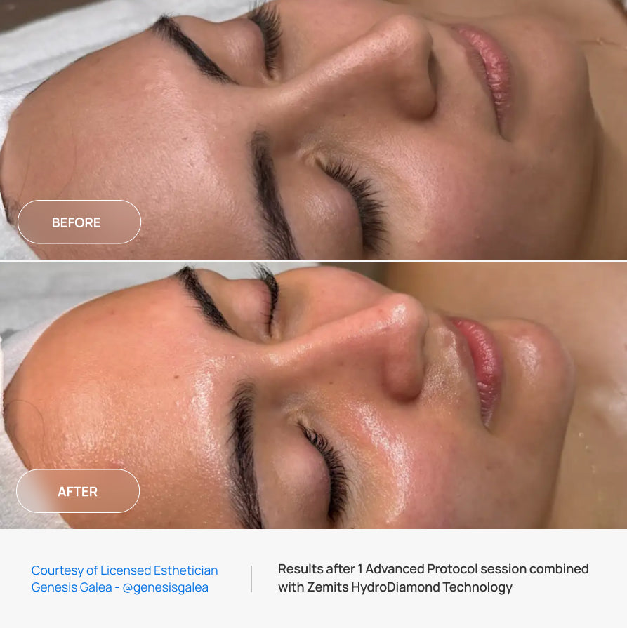 Before After Slide 4