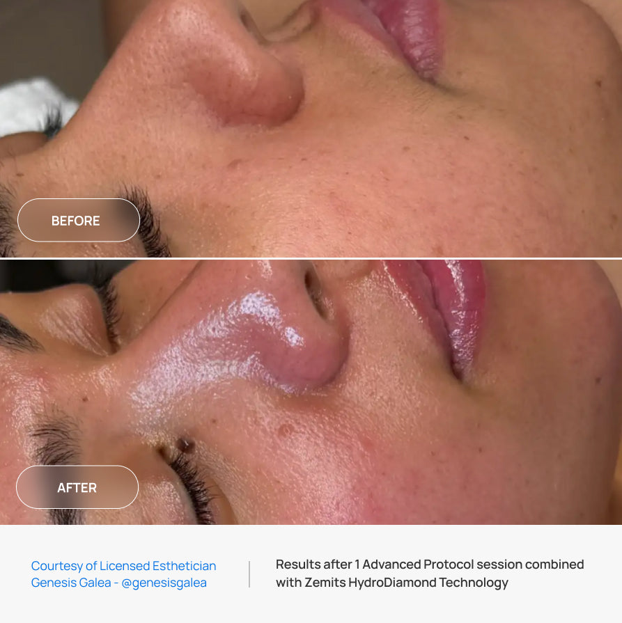 Before After Slide 5