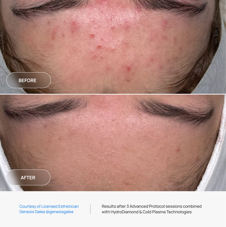Before After Slide 2