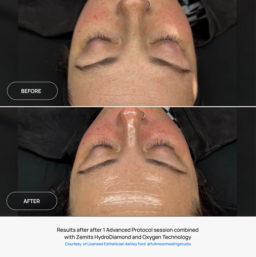 Before After Slide 3