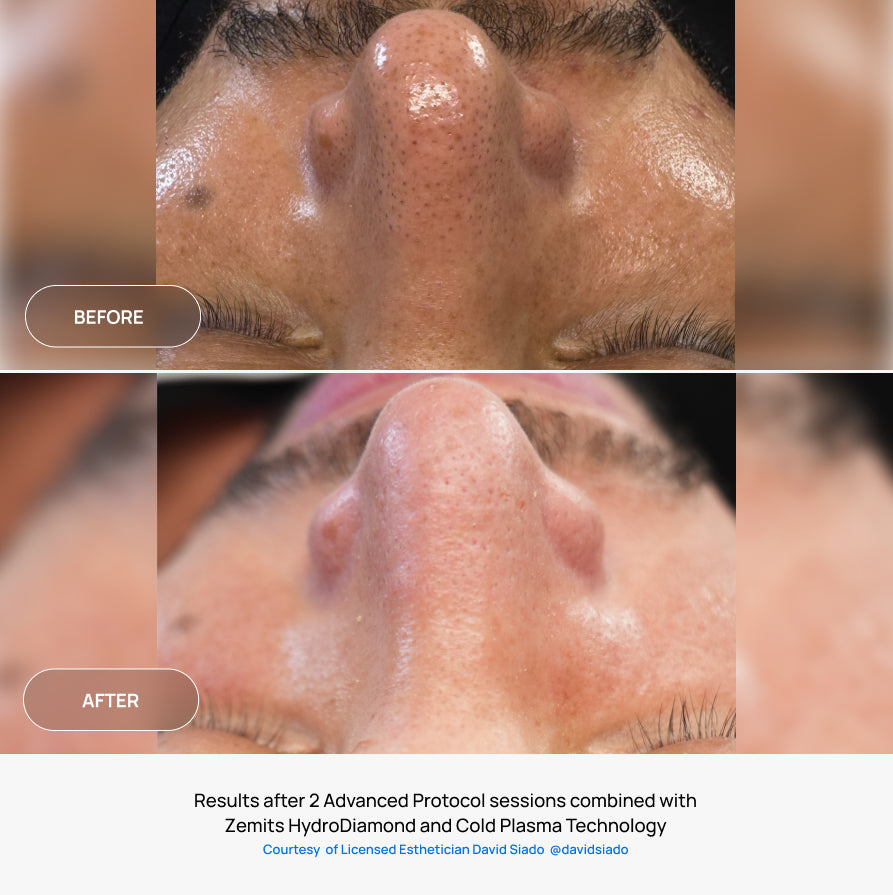Before After Slide 6