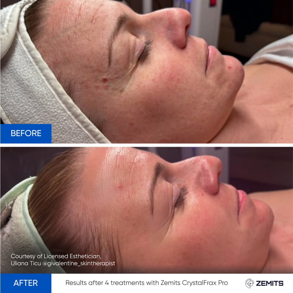 Before After Slide 2