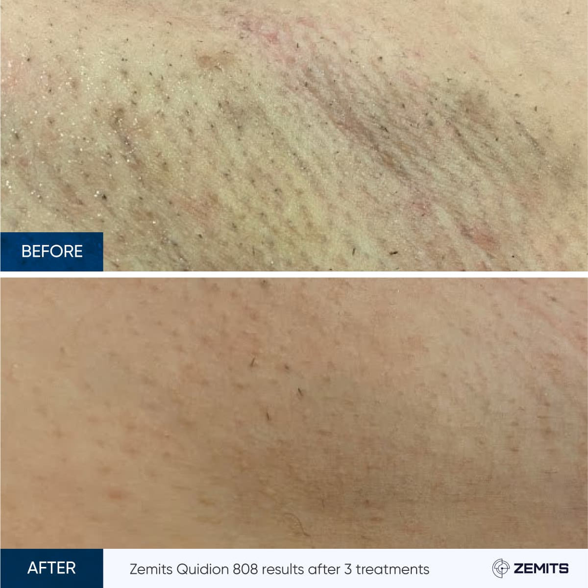 Before After Slide 12