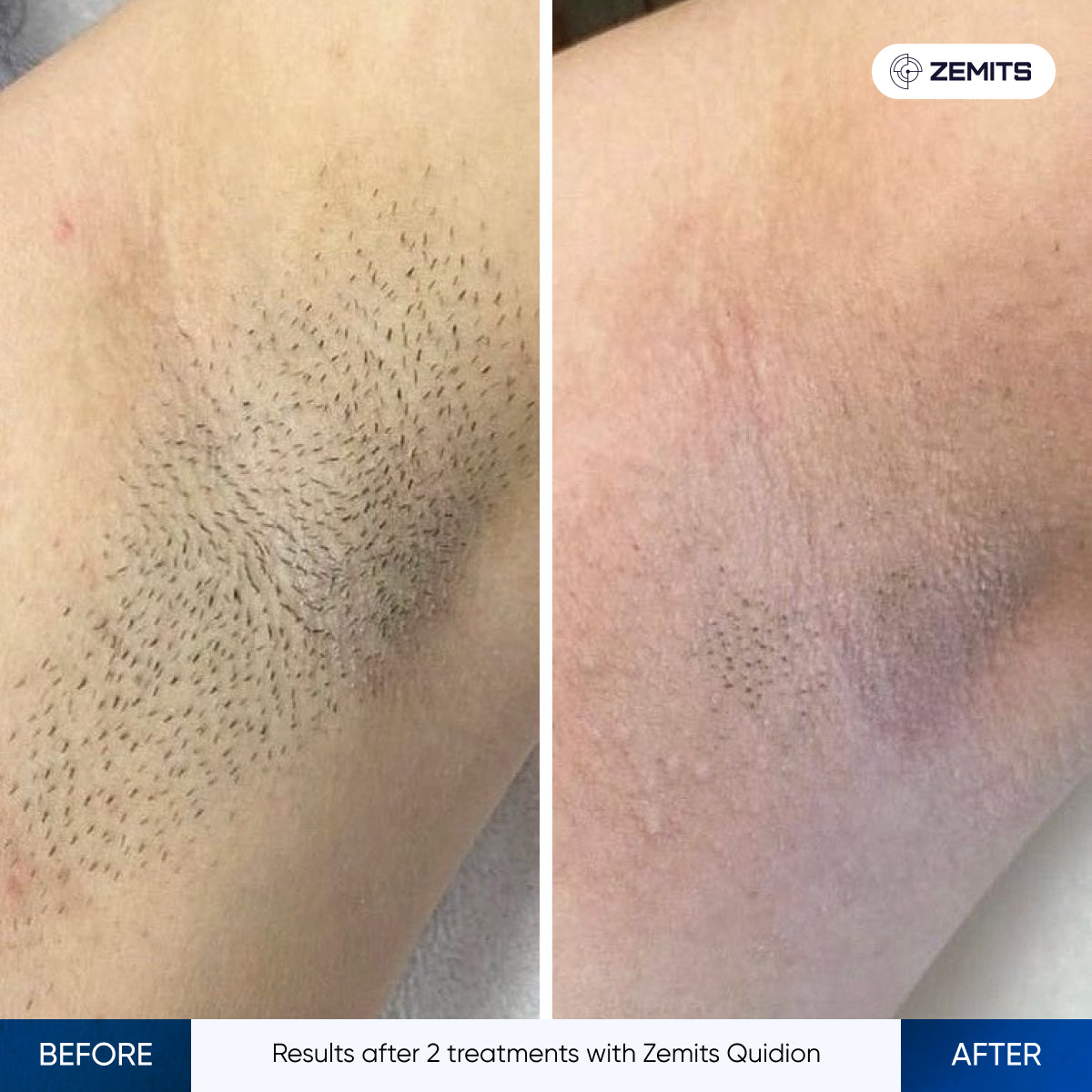 Before After Slide 15