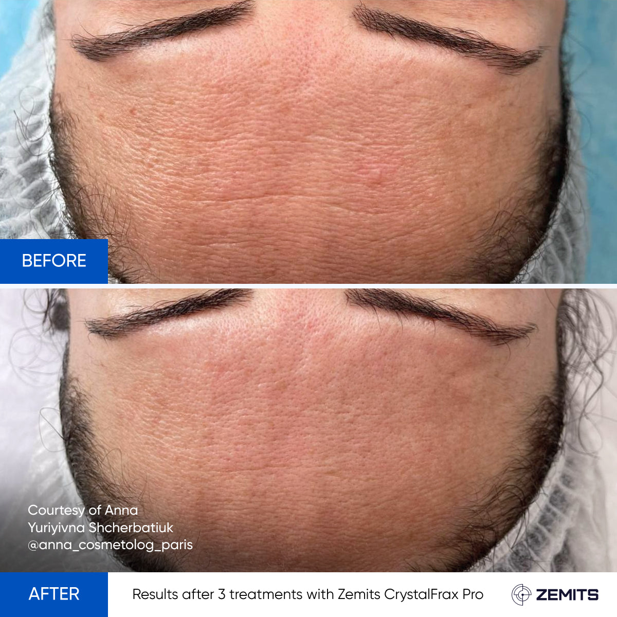 Before After Slide 23